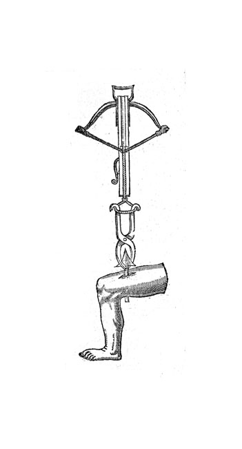 Schwarz-wei&szlig;e Linienzeichnung einer Armbrust, die einen Pfeil aus einem Unterschenkel zieht