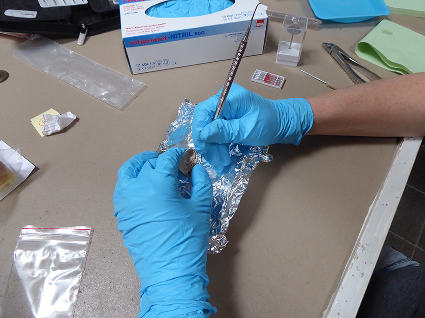 Zahnsteinentnahme an der Universit&auml;t G&ouml;ttingen 